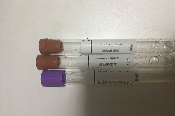要进行亲子鉴定的离婚协议